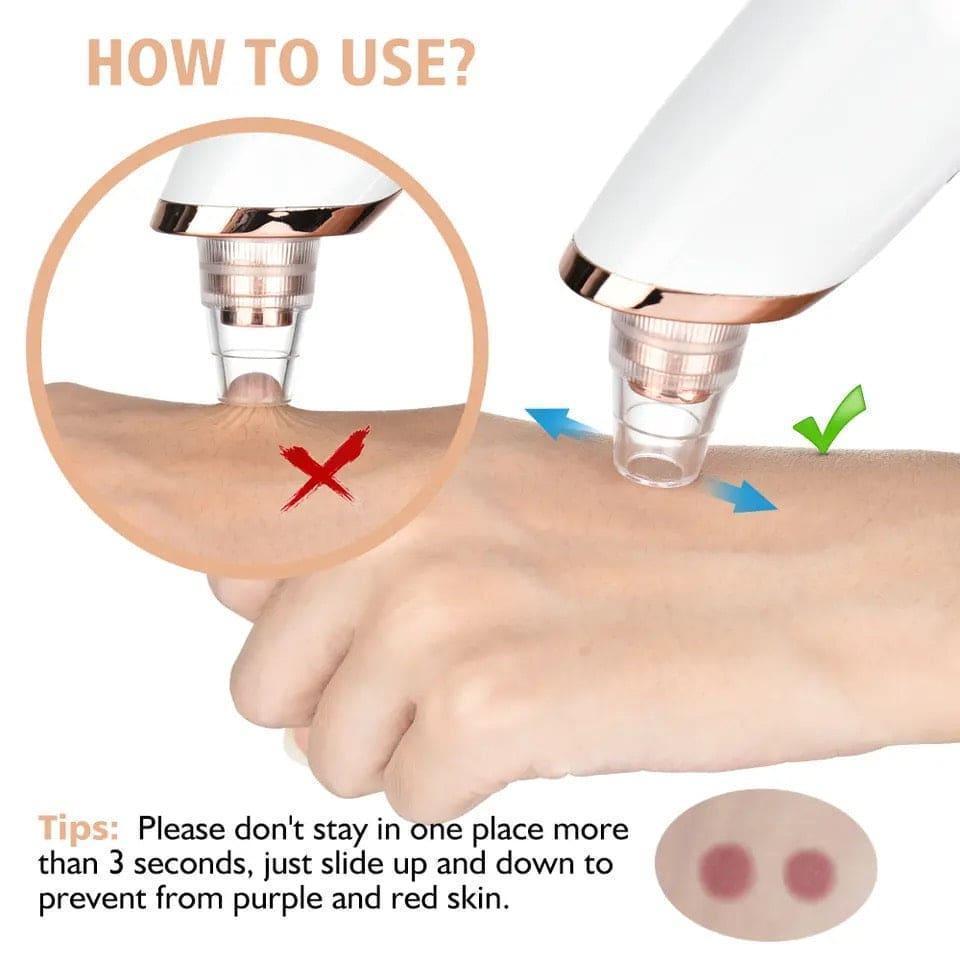 Travel Friendly Blackhead Remover for All Skin Types
