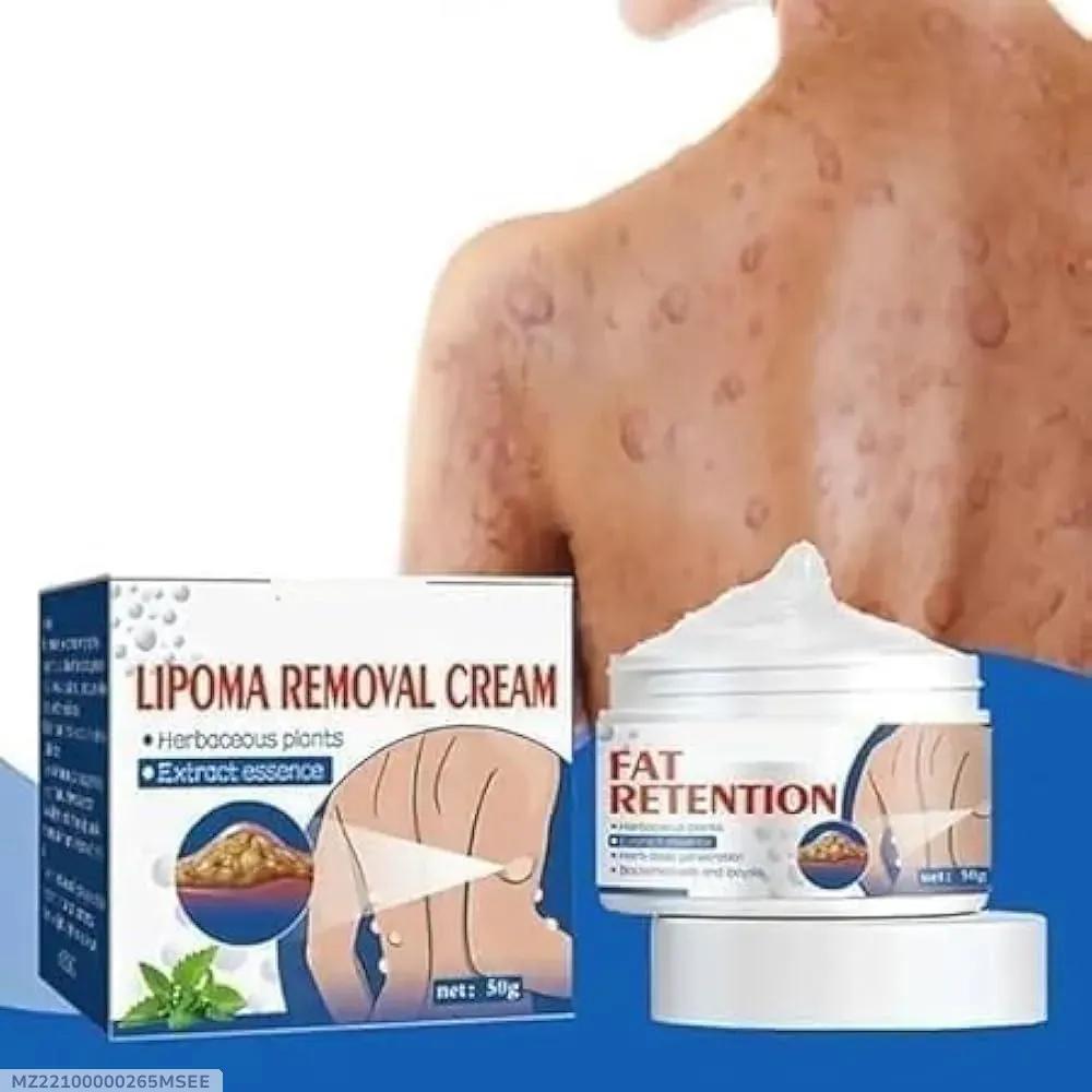Lipoma Removal Cream 50gm Body Smoothing