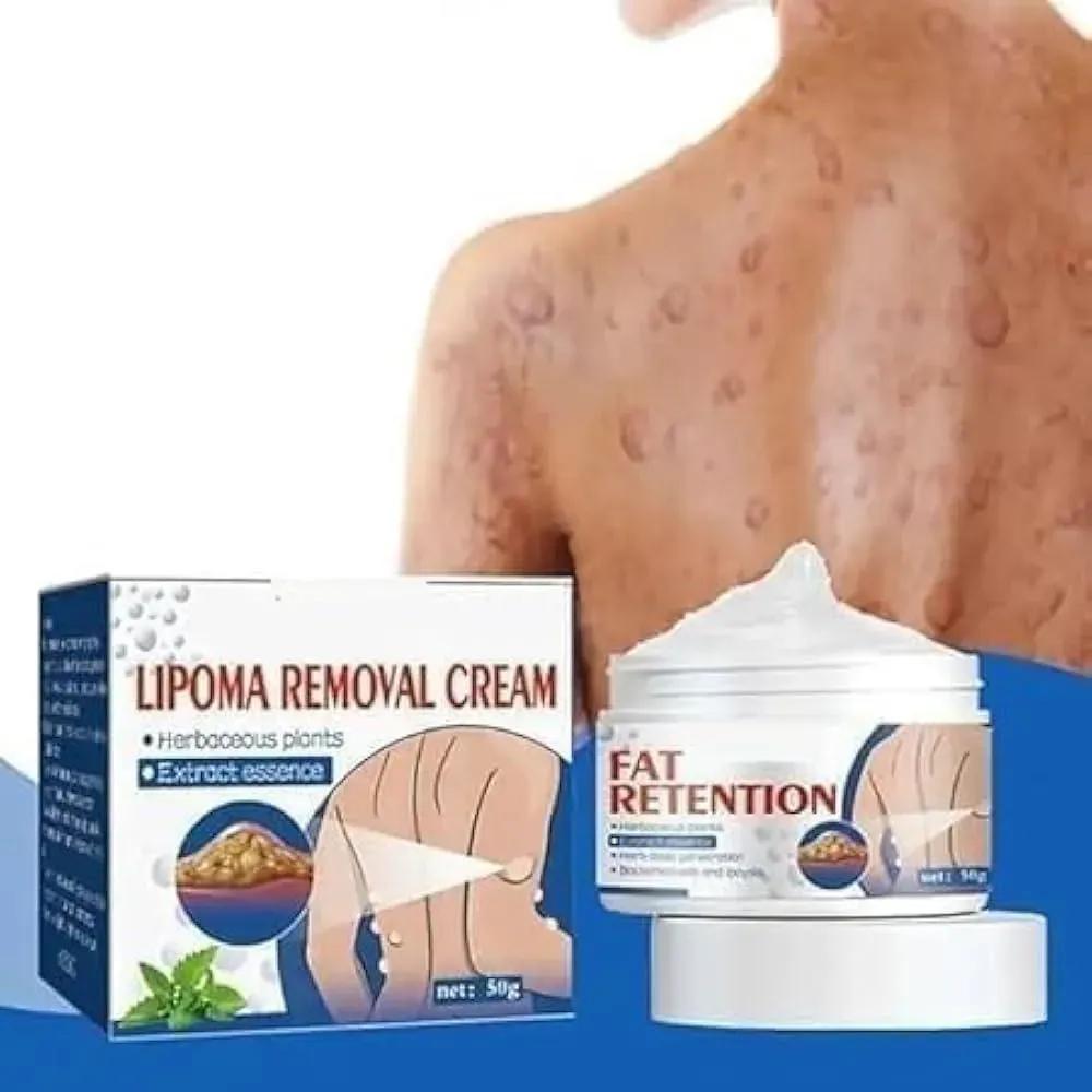 Lipoma Removal Cream 50gm Body Smoothing