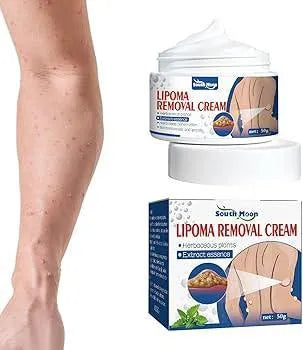 Lipoma Removal Cream 50gm Body Smoothing