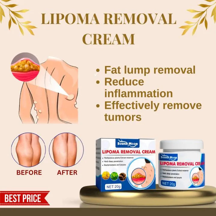 Lipoma Removal Cream 50gm Body Smoothing